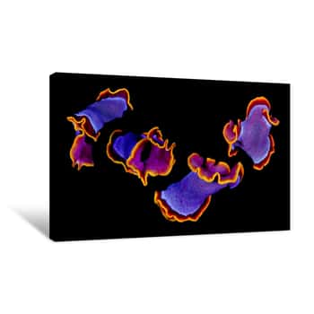 Image of Purple Flat Worms Canvas Print